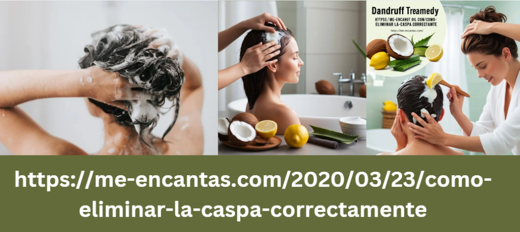 https://me-encantas.com/2020/03/23/como-eliminar-la-caspa-correctamente